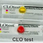 Έλκος στομάχου